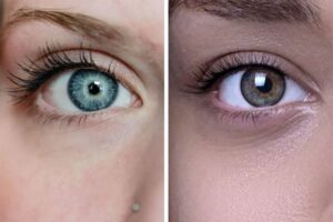 Pourquoi Les Personnes Aux Yeux Bleus Sont Elles Si Uniques